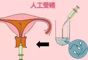 代孕