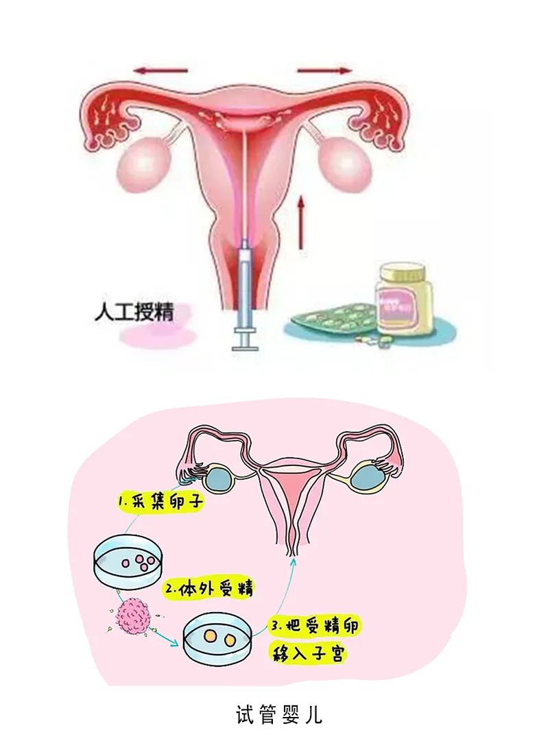 代孕