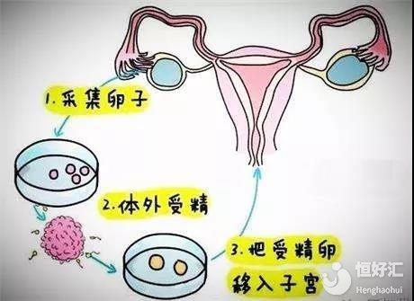 代孕 亲人